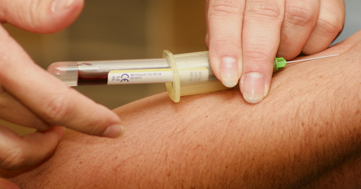 Vitamine B12 boven of onder de norm: oorzaken bij sporters en wat te doen